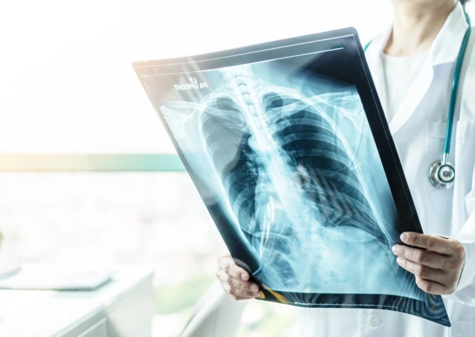 Lekarka trzymająca zdjęcia rentgenowskie płuc